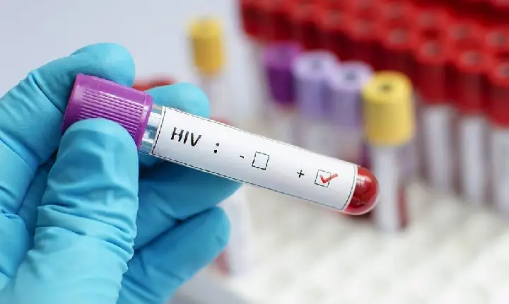 BRASIL VAI NA CONTRAMÃO DA TENDÊNCIA GLOBAL E REGISTRA ALTA DE NOVOS CASOS DE HIV