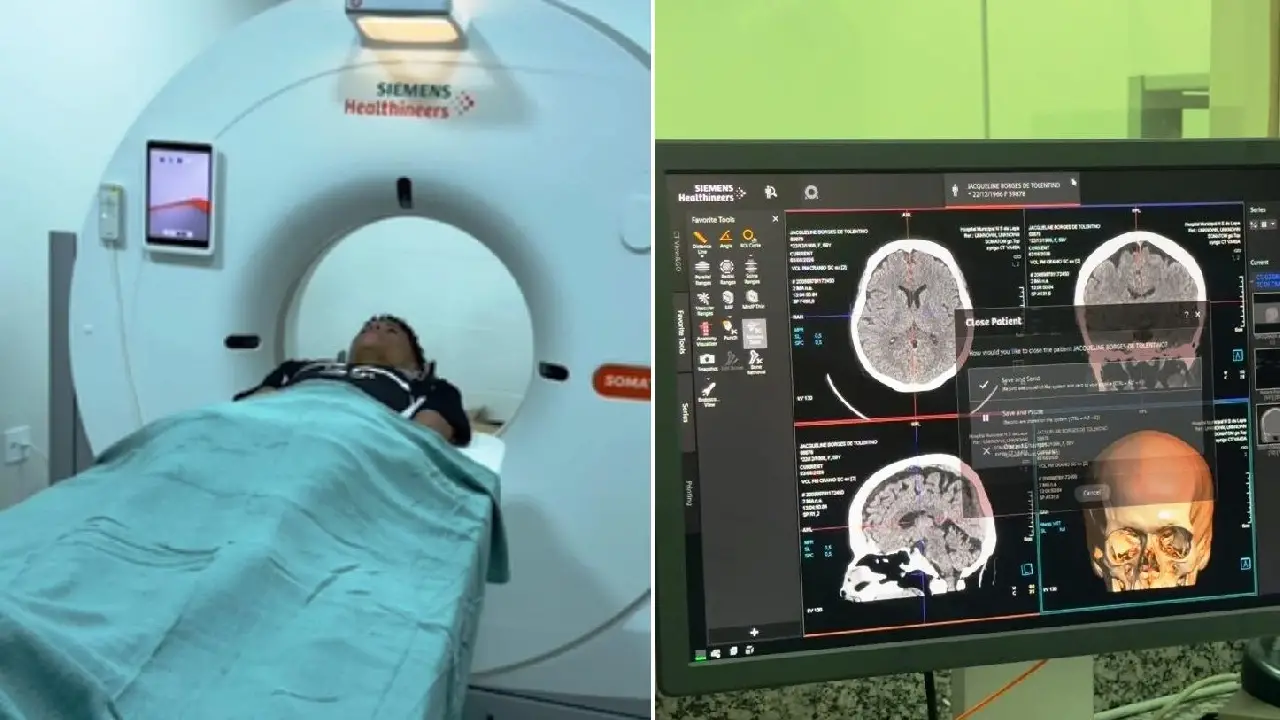 HOSPITAL MUNICIPAL DE VAZANTE INICIA ATENDIMENTO COM EXAMES DE TOMOGRAFIA