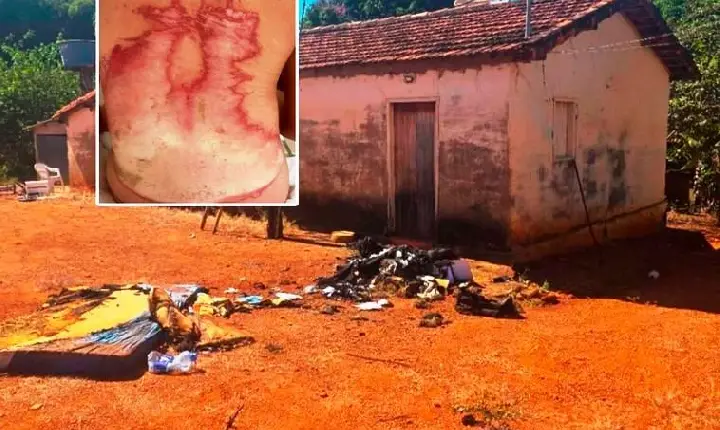 POLÍCIA APURA CASO DE INCÊNDIO EM COMUNIDADE DE LAGAMAR QUE DEIXOU JOVEM COM QUEIMADURAS GRAVES