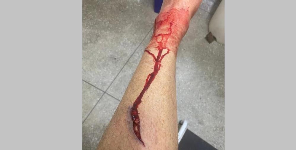 VAZANTE: CÃO DE RUA ATACA E FERE CICLISTA NO BAIRRO NOVO HORIZONTE