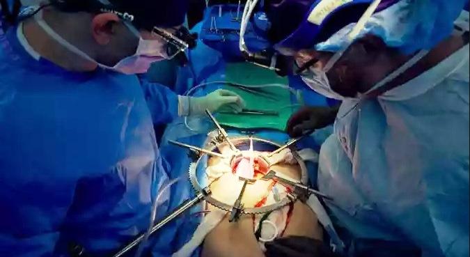 VETERANO DA MARINHA AMERICANA RECEBE CORAÇÃO DE PORCO EM TRANSPLANTE NOS EUA