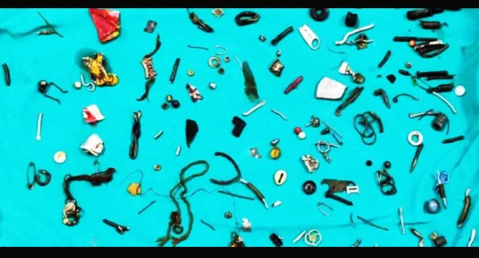 MÉDICOS ENCONTRAM 60 OBJETOS EM INTESTINO DE INDIANO COM TRANSTORNO DE PICA