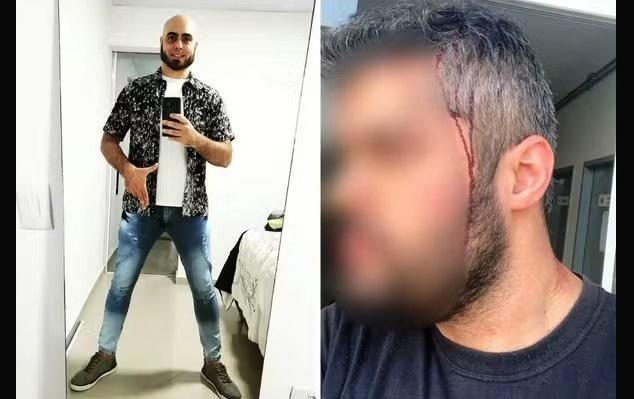 TRIBUNAL MUDA LOCAL DO JULGAMENTO DE SOBRINHO DE BOLSONARO POR TENTATIVA DE HOMICÍDIO