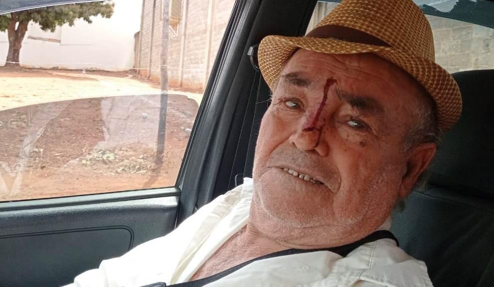 IDOSO É VÍTIMA DE AGRESSÕES E TENTATIVA DE ASSALTO EM VAZANTE