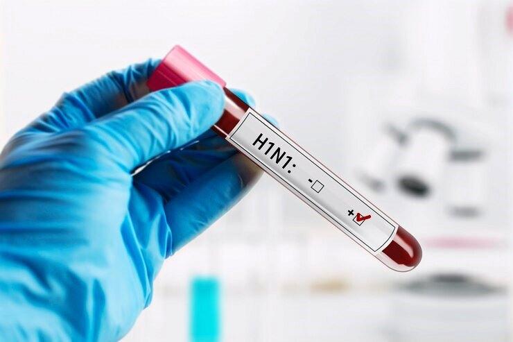 ESCOLAS DE GOIÁS SÃO INVESTIGADAS POR SURTO DE H1N1 APÓS MORTE DE DOIS ESTUDANTES