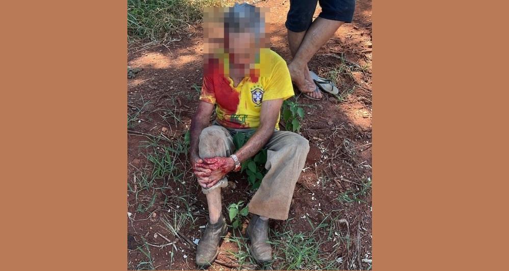 HOMEM FRATURA COSTELAS E CLAVÍCULA AO CAIR DE BICICLETA EM RODOVIA RURAL DE VAZANTE