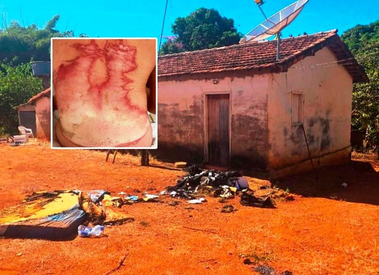 POLÍCIA APURA CASO DE INCÊNDIO QUE DEIXOU JOVEM COM QUEIMADURAS GRAVES EM COMUNIDADE DE LAGAMAR