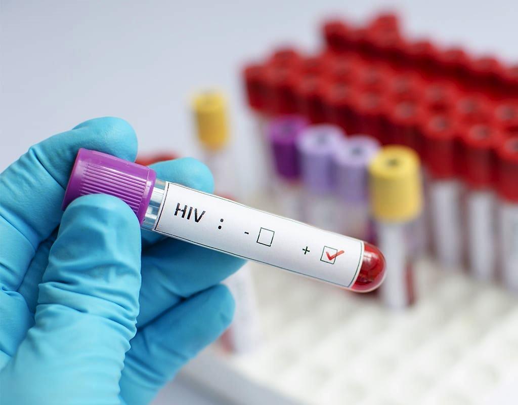 BRASIL VAI NA CONTRAMÃO DA TENDÊNCIA GLOBAL E REGISTRA ALTA DE NOVOS CASOS DE HIV